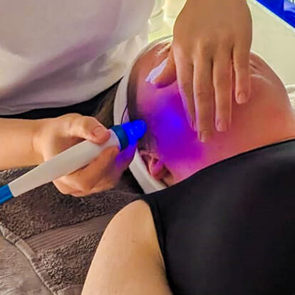 Photo of a lady receiving skin renewal treatment