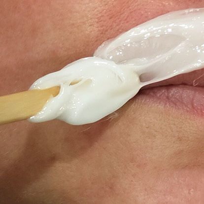 Photo of face hair removal using no-tweeze wax