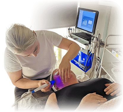 A photo of laser treatment