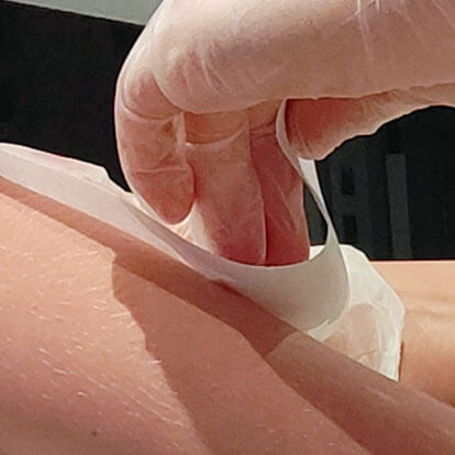 Photo of hair removal using strip wax