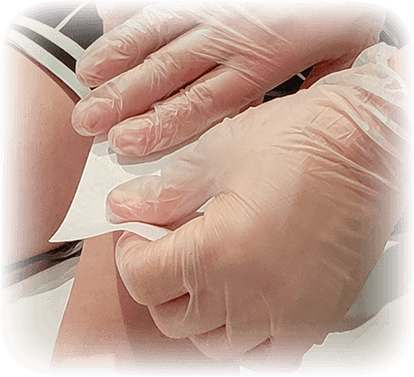 Hair removal from an thigh using wax